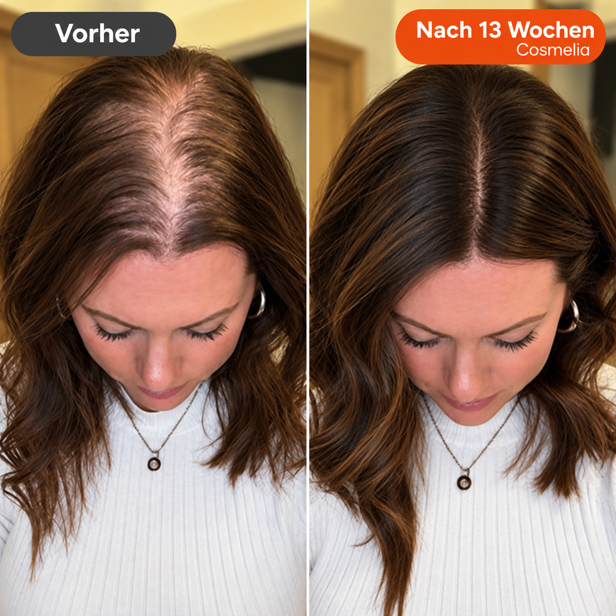 Nr. 1 Koreanisches Wachstums und Dichteserum 🇰🇷