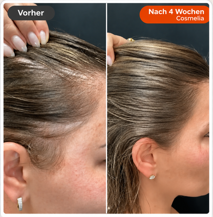 Nr. 1 Koreanisches Anti-Haarausfall-Serum 🇰🇷