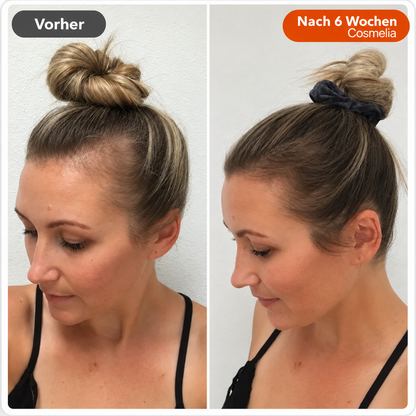 Nr. 1 Koreanisches Anti-Haarausfall-Serum 🇰🇷