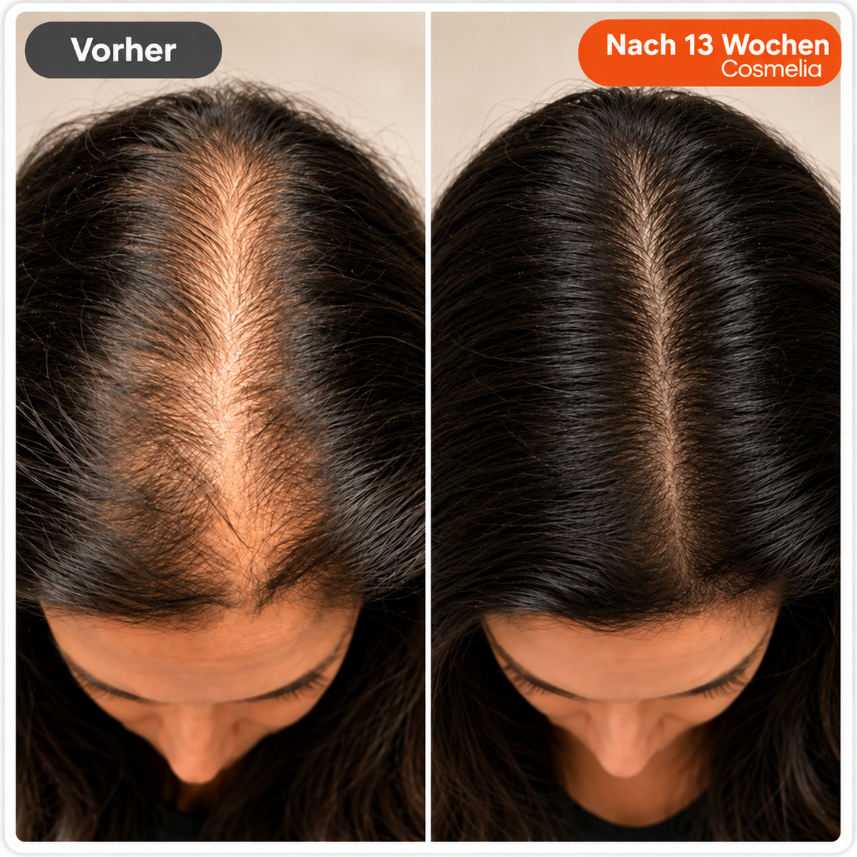 Nr. 1 Koreanisches Anti-Haarausfall-Serum 🇰🇷